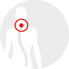 Target showing area needing neck pain treatment