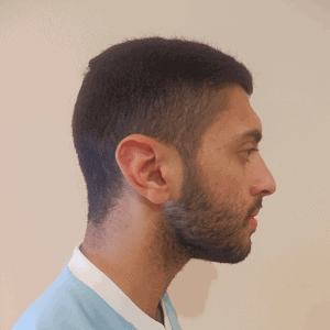 Neck stretches - Chin tuck start position