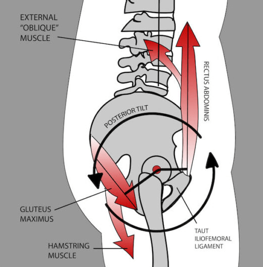 The Ultimate Guide To Posture Correction - Spine & Posture Care Sydney