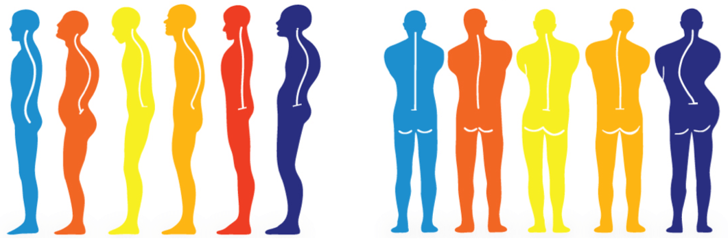 Does a Posture Corrector Brace Work?  Postures, Bad posture, Posture  correction brace