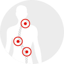 Posture Correction